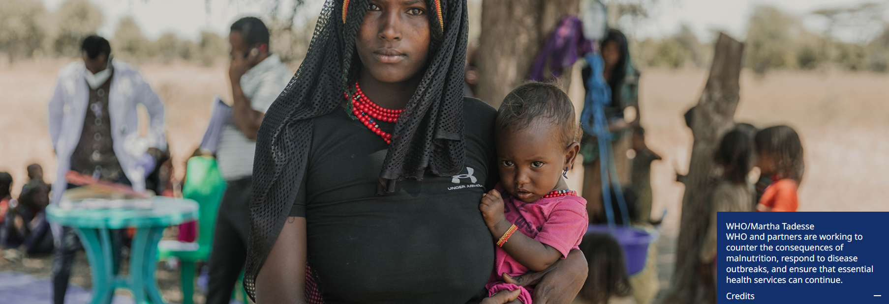 WHO issues new guideline to tackle acute malnutrition in children under five